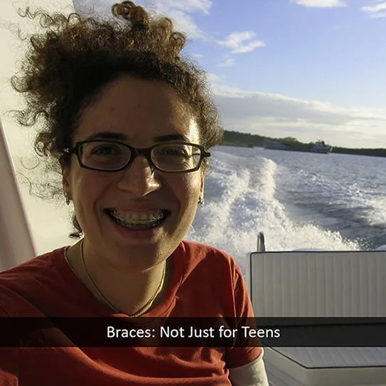 adult-braces