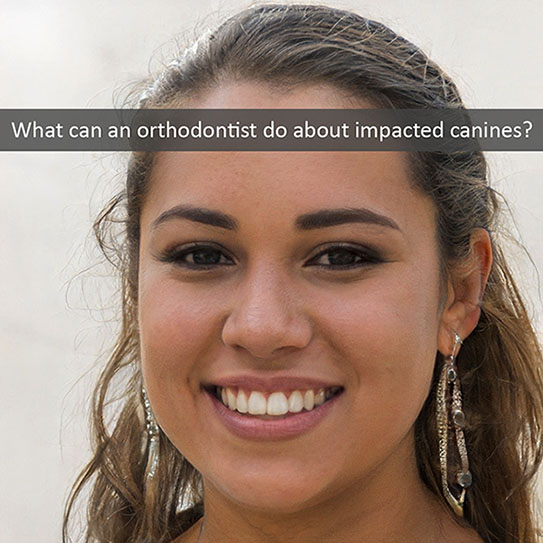 Girl impacted-canines