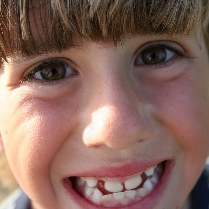 interceptive-orthodontics